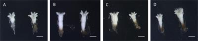 Effect of Thermal Stress on Tissue Ultrastructure and Metabolite Profiles During Initiation of Radiata Pine Somatic Embryogenesis